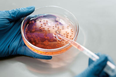 MicroBios Lab Analyses Microbiological